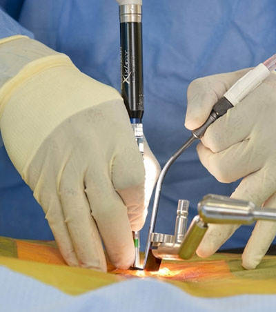 Minimally Invasive Surgery