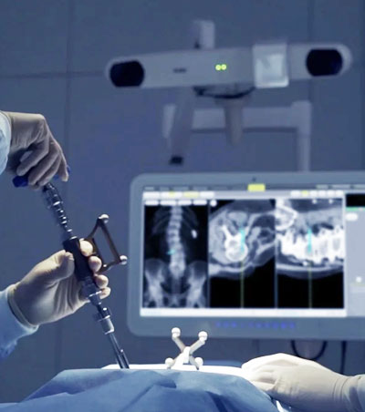 Navigated Spine Surgery